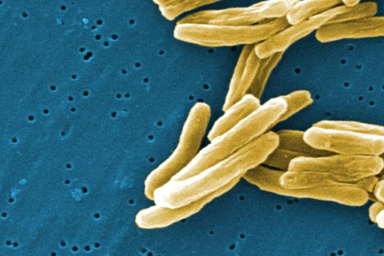 Mycobacterium tuberculosis