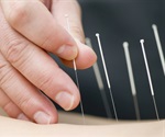 Acupuncture improves pain and function in older adults with chronic low back pain