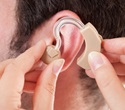 Hearing aid use has little impact on cognitive test scores