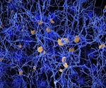 Plaques impair memory formation in Alzheimer’s disease during sleep