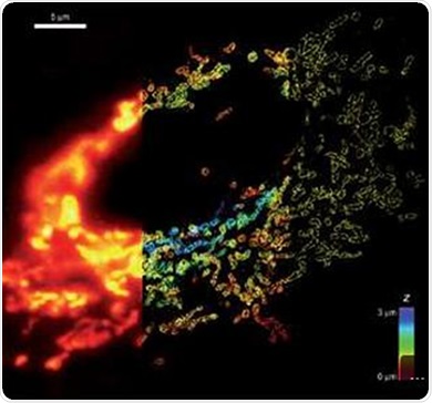 Whole cell 3D super-resolution imaging by STORM