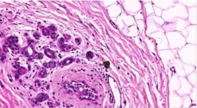20X magnification of breast tissue specimen with 0.5μm resolution
