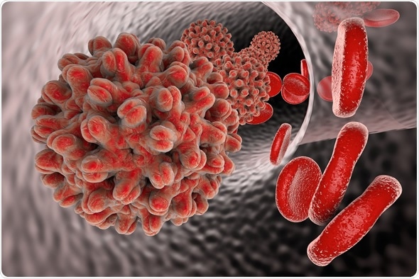 Hepatitis B virus in blood vessel with red blood cells. A model of virus is built using data of viral macromolecular structure furnished by Protein Data Bank (PDB 4G93). Image Copyright: Kateryna Kon / Shutterstock
