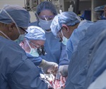 First US uterus transplant is successful