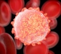 Breakthrough immunotherapy approved for treatment of adults with aggressive blood cancer