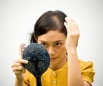 Female Pattern Hair Loss
