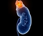 FDA updates Byetta prescribing information following reports of kidney problems