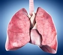 Pandorabactins help pathogenic bacteria compete for iron in the lungs