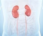 Symptoms and Causes of Acquired Cystic Kidney Disease