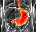 Scientists uncover hints of a potential new cause of stomach cancer