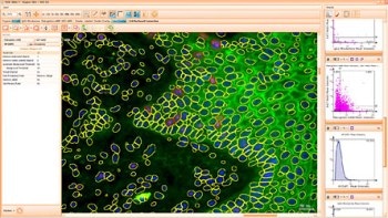 TissueQuest Analysis Software from TissueGnostics