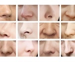 Climate is a driving factor for human nose shape