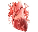 Study sheds new light on the role of NSUN2 protein in cardiac hypertrophy and heart failure