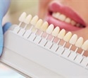 Uneven tooth color matters more than whiteness for young adults