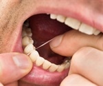 Why is it Important to Floss?