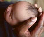 Report reveals differences in non-Hispanic black and white infant mortality rates in the US
