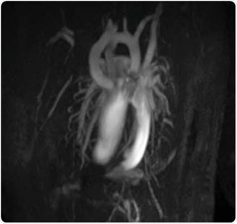 Mouse Coronary Artery lmaging.