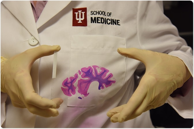 Completed, stained brain section with coverslip. P