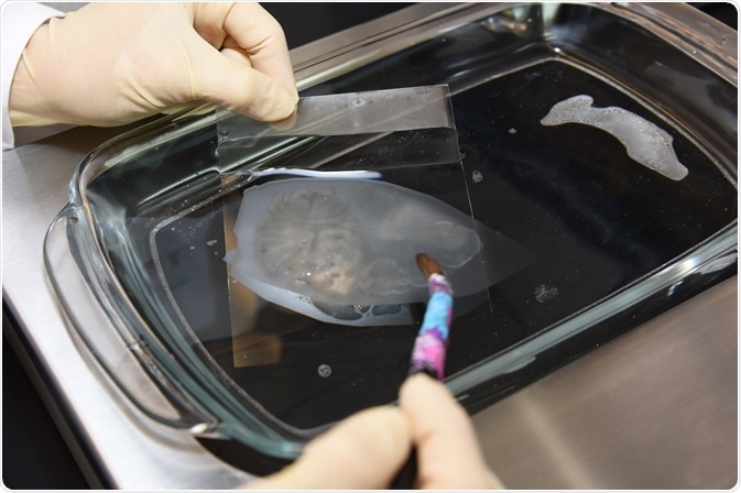 Mounting of thin brain section onto slide.