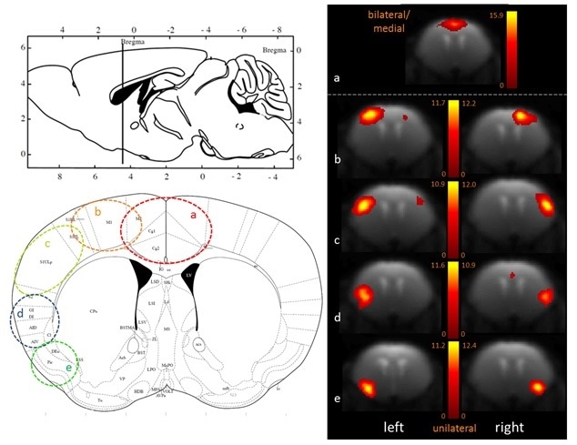 Fine-grained segregation of the cortical mouse brain functional connectivity revealed with 100-ICASSO. Bi- (a) and uni-lateral left and right ICs (b–e), matching well defined anatomical areas (see he atlas axial image - Paxinos and Franklin, 2001) are displayed.