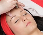 How is Dermabrasion Carried Out?