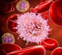 Hidden cell structures reveal a common weakness in leukemia