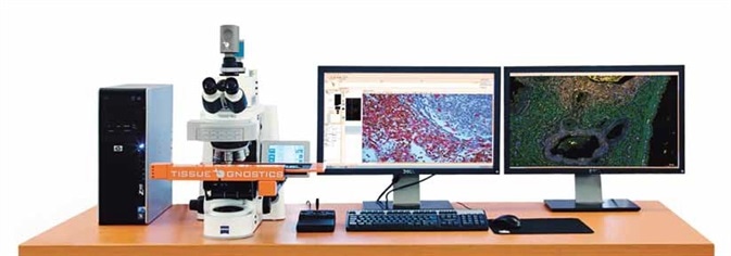 This new technology allows to better understand the molecular mechanisms of disease formation. This is required for choosing the optimal therapy for any given patient and to avoid that a patient receives an ineffective treatment.