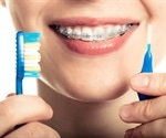 Taking Care of Your Teeth with Braces