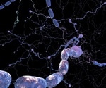 Study reveals mechanism behind failed remyelination in MS