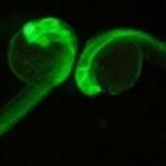 Slide Show of Fluorescing Zebrafish