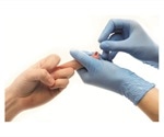 EKF Diagnostics publishes new capillary blood sampling guide