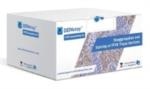 DEPArray Kits from Menarini Silicon Biosystems