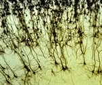 Discovery of unique brain cells sheds light on progressive multiple sclerosis