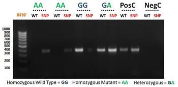 Warfarin Genotyping (VKORC1) Kit from Bio-Synthesis