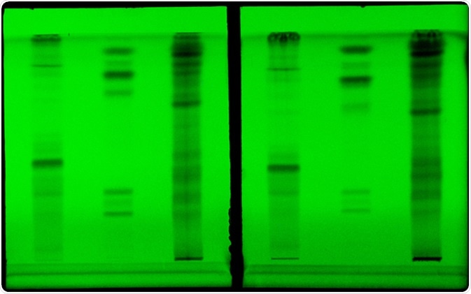 Thin layer chromatography. Image Credit: Sruilk / Shutterstock
