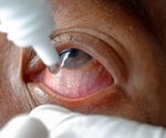 Health Risks and Benefits of Eye Drops