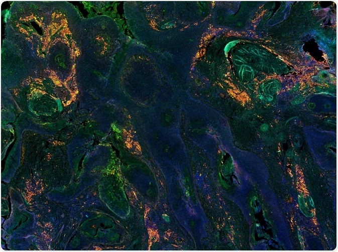 Antibodies labeling a tissue sample - By Carl Dupont