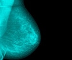 Microwave Imaging for Breast Cancer: Procedure