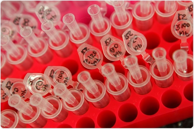 A new study points to the need for better antibody validation, and outlines a process that other labs can use to make sure the antibodies they work with function properly. Image Credit: The Neuro