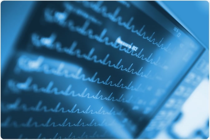 Drinking small amounts of alcohol frequently is linked with a higher likelihood of atrial fibrillation than binge drinking. Image Credit: sfam_photo / Shutterstock