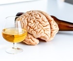 Boozing leads to small brains or people with small brains drink more?