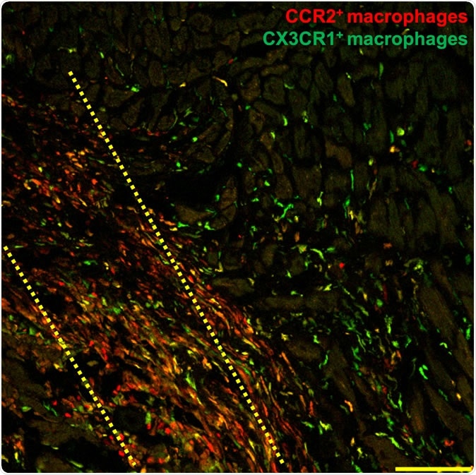 In this microscopic histology image, macrophage immune cells (shown in red and green) flock to the injured region of a damaged mouse heart three days after researchers injected adult heart stem cells within the yellow dotted area. Researchers report Nov. 27 in Nature that stem cell therapy helps hearts recover from heart attack by triggering an innate immune response that alters cell activity around the injured area so that it heals with a more optimized scar and improved contractile properties.