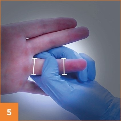 Step 5 in taking a blood prick