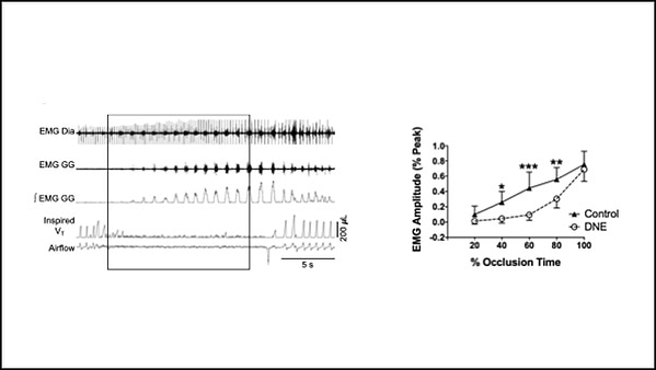 Fetal nicotine exposure obstructs breathing in babies