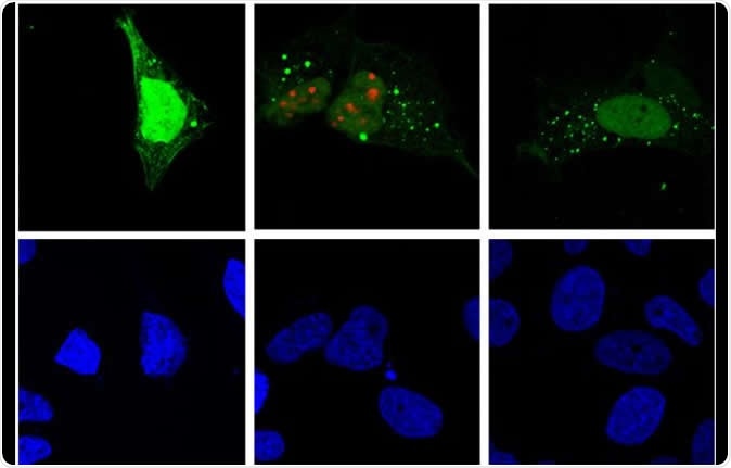 Hepatitis D virus replication (red) induces autophagy (green) in the host cell (fluorescence microscopy). Image Credit: Patrick Labonté, INRS / Shutterstock