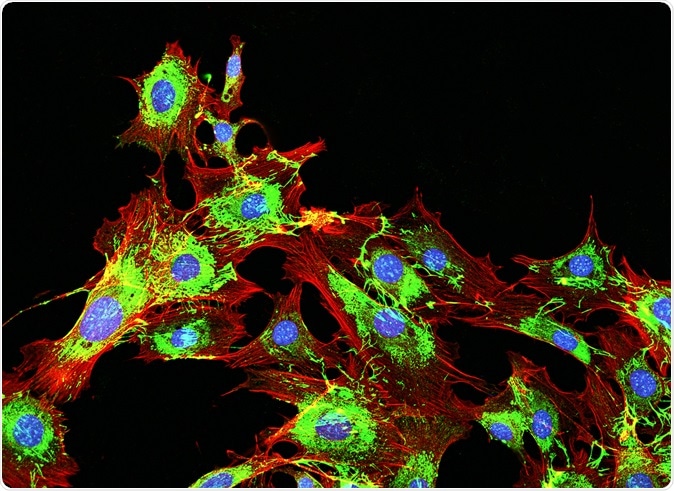 Imaging of metastatic cancer cells spreading on the surrounding tissue. Image Credit: DrimaFilm / Shutterstock