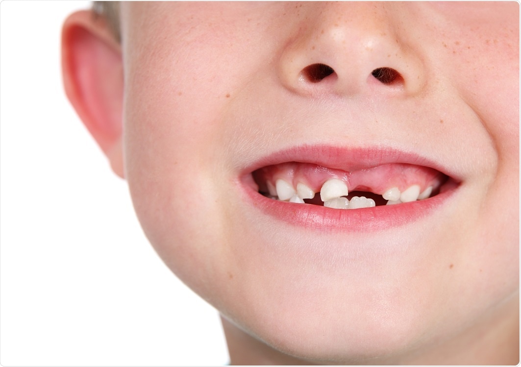Child with missing teeth