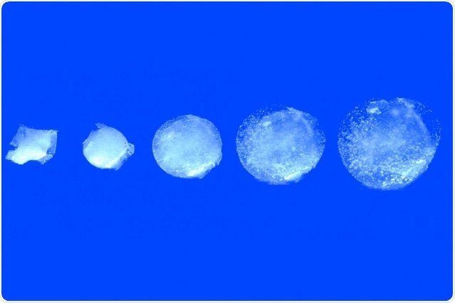 The ingestible hydrogel device swells in water with high speed and high ratio. Image: Xinyue Liu