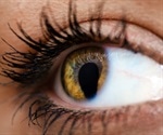 What are the Symptoms of Coloboma?