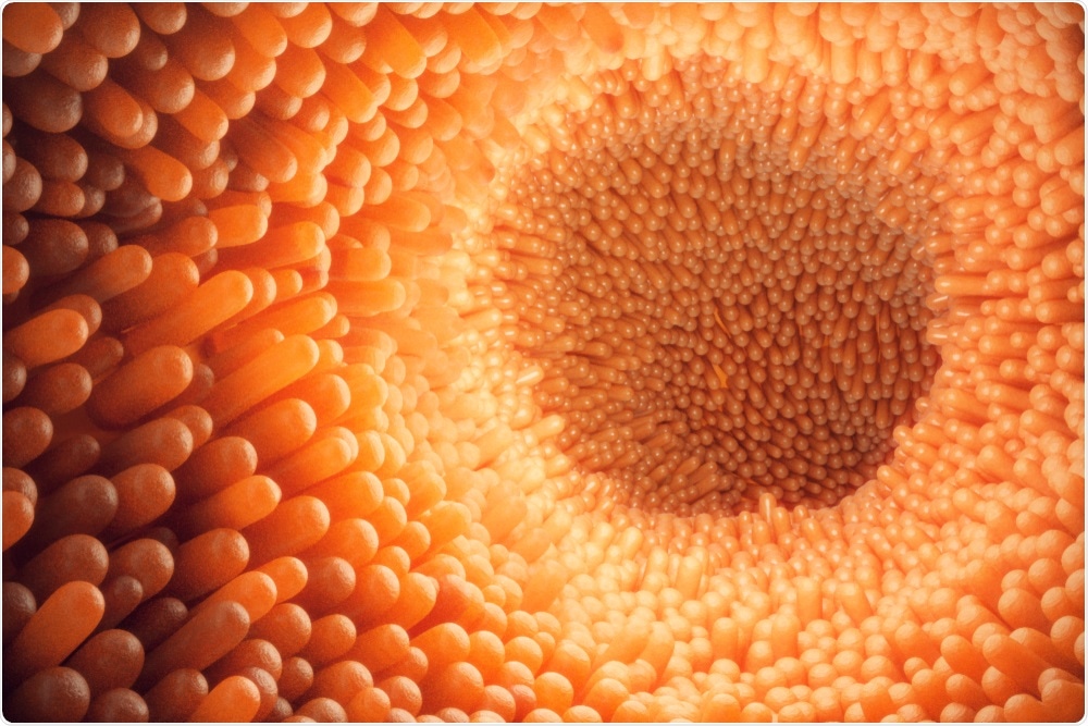 Image of the intestine